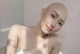 Bức ảnh của cô gái TP.HCM mắc ung thư ở tuổi 28 viral khắp MXH