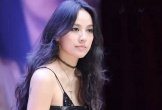 Nữ ca sĩ nổi tiếng bị thương dẫn đến biến dạng ngón tay