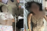 Nghi dùng súng bắn mẹ và 