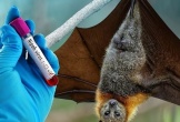 Virus Nipah chưa có vaccine và thuốc điều trị đặc hiệu, nguy cơ di chứng lâu dài