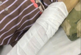 Clip: Kinh hãi cô gái bị máy ép nước mía cuốn xoay nhiều vòng ở TPHCM