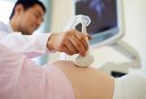 Từ 1/7/2026, những ai được ưu tiên khám sàng lọc bệnh bẩm sinh trước sinh và sơ sinh?
